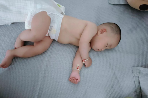 平顶山六个月宝宝眼睛散光